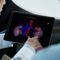 software di pianificazioneIntuitive Intuitive Surgical