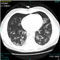 software di diagnosi del Covid-19COVID-19 AI Diagnostic AssistantNovarad