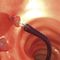 cestello endoscopico per estrazione di polipi intestinaliSensor®G-FLEX Europe