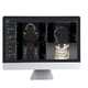 software di analisi / di visualizzazione 3D / diagnostico / di pianificazione del trattamento