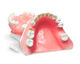 modello anatomico di denti / gengivale / per implantologia / didattico