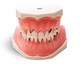 modello anatomico di denti / gengivale / per parodonzia / didattico
