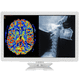 monitor chirurgico / per endoscopia / per laparoscopia / Full HD