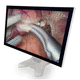 monitor medico / 1920 x 1080 / 23,8