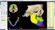 software di pianificazione preoperatoria / di trattamento / di analisi / di verifica