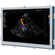 monitor per ecografia / 1280 x 1024 / 19