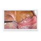 monitor medico / per endoscopia / per sala operatoria / 3840 × 2160