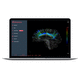 software MRI / per imaging cerebrale / per MRI funzionale / per neurochirurgia