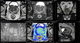 software di analisi / per reportistica / visualizzatore / MRI