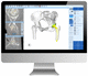 software per ospedale / per tomografia computerizzata / per chirurgia dell'anca / di analisi