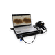 videodermatoscopio / LED bianca / per PC / Full HD