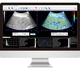 software per ecografia / di visualizzazione / diagnostico / di interpretazione