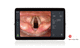 videoprocessore per endoscopia / con videomonitor / per immagini full HD