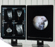 PACS per diagnostica per immagini / basato sul web / medico