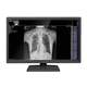 monitor medico / diagnostico / per diagnostica per immagini / per radiologia