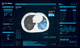 software di analisi / per reportistica / di trattamento / di validazione