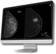 software medicale per tomosintesi mammaria / di analisi / di interpretazione / per screening del tumore al seno