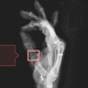 software di diagnosi di fratture / di analisi / di visualizzazione / diagnostico