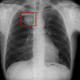 software medico / di visualizzazione / di diagnosi di fratture / per screening del tumore del pomone