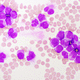 kit di test per LAM / per le neoplasia mieloproliferativa / di oncologia / per medicina di precisione