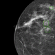 software per screening del tumore al seno / di analisi / diagnostico / medico