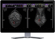 piattaforma AI per ospedali / per diagnostica per immagini / di apprendimento automatico / visualizzatore