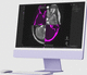 software medico / di progettazione / di trattamento / di pianificazione