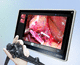 videoregistratore con conversione file DICOM / diagnostico / con touch screen / 4K