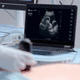 simulatore didattico / per ecografia / di anatomia / workstation