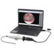 workstation per endoscopia / per computer portatile