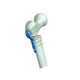 placca per osteotomia per femore / prossimale / distale / bloccata