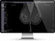 PACS per diagnostica per immagini