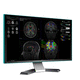 software medico / MRI / per MRI funzionale / di analisi