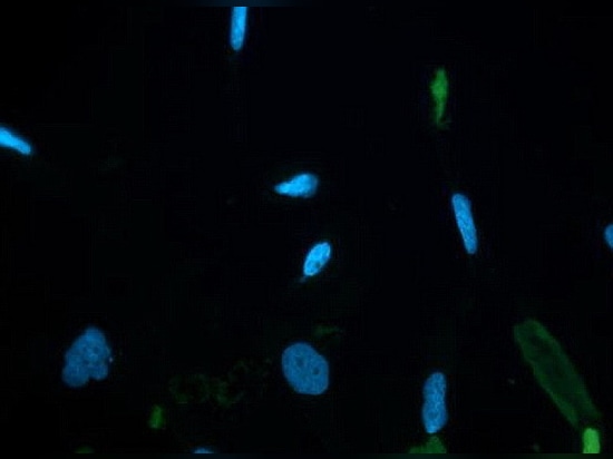 Cellule nervose macchiate da DAPI