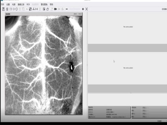 Applicazione del laser speckle imaging alla ricerca sull'ictus ischemico