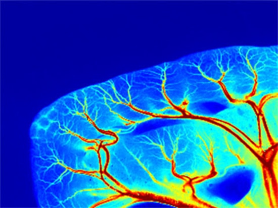 Nuovo prodotto| RFLSI ZW Laser Speckle Contrast Imaging System: un'esperienza di imaging senza pari