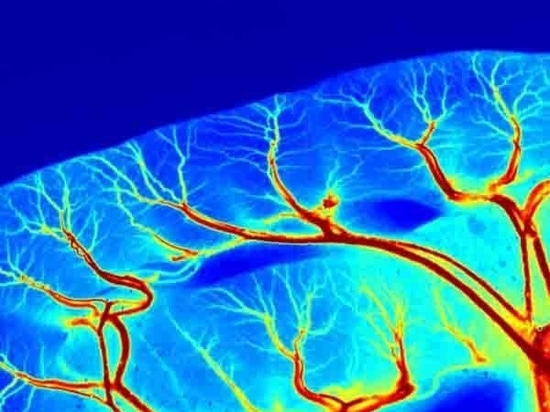 Introduzione dettagliata di RFLSI ZW Laser Speckle Contrast Imaging System