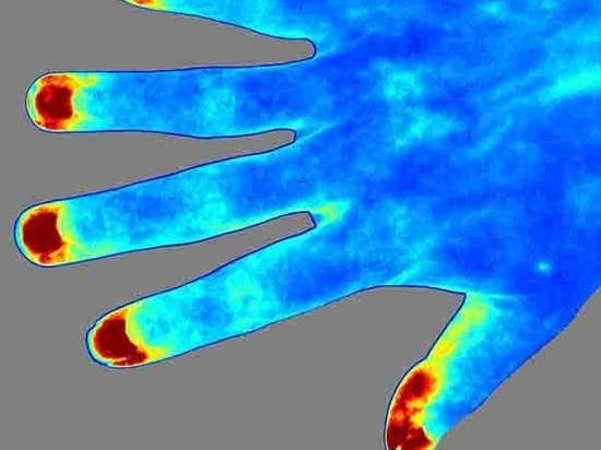 Introduzione dettagliata di RFLSI ZW Laser Speckle Contrast Imaging System