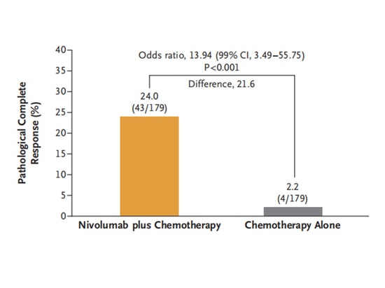 Breve sintesi dei progressi della ricerca sull'immunoterapia neoadiuvante nel NSCLC