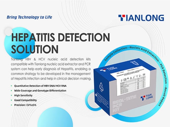 Il kit ultrasensibile per la rilevazione dell'HBV DNA e dell'HCV RNA sviluppato dalla Tianlong