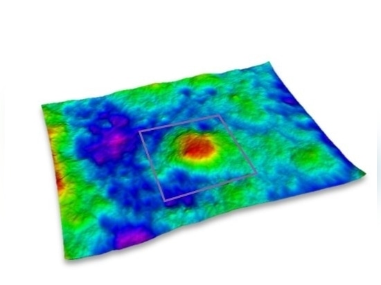 Valutazione dell'elevazione dei brufoli