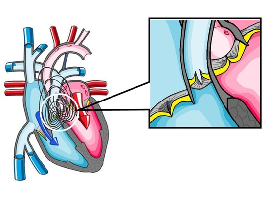 Il 9 marzo ascolteremo lo sdoppiamento del suono del cuore.