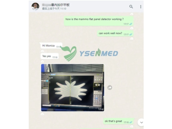 Il rivelatore mammografico a schermo piatto YSENMED YSFPD-R1012C funziona bene in un ospedale del Senegal.