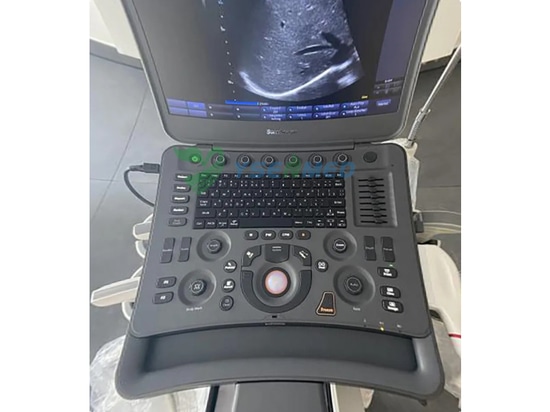 Feedback dell'ecografo portatile 4D Color Doppler
