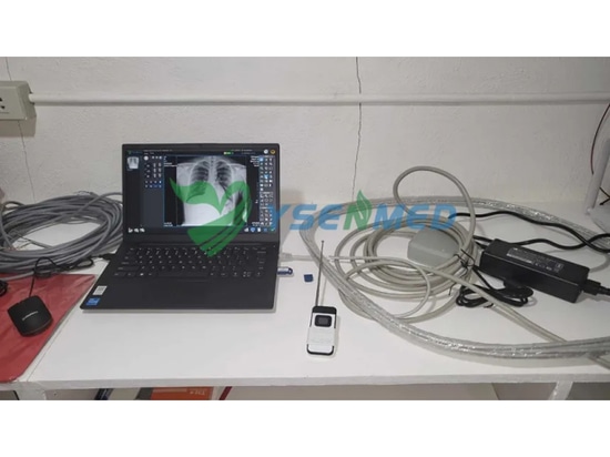 I medici filippini sono soddisfatti dell'apparecchio radiografico digitale portatile YSENMED YSX056-PE.