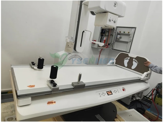 Caso del sistema di radiografia digitale dinamica YSENMED