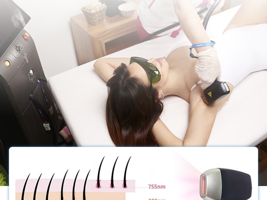 CJ-HR-1 sistema laser a diodo da 3000 W ad altissima potenza per la depilazione