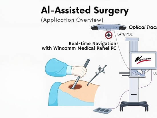 Trasformare la chirurgia con l'assistenza dell'intelligenza artificiale