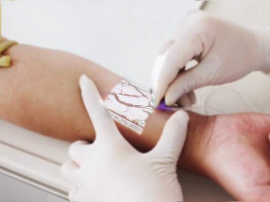 Come funzionano i localizzatori di vene a proiezione nella sanità moderna