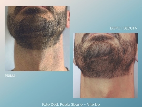 Prima e Dopo
